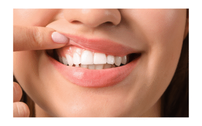 Protect Your Smile: Gum Disease Prevention & Treatment