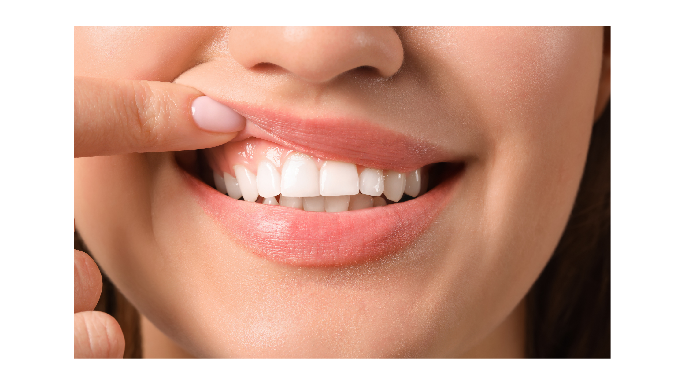 gum-disease-prevention-treatment
