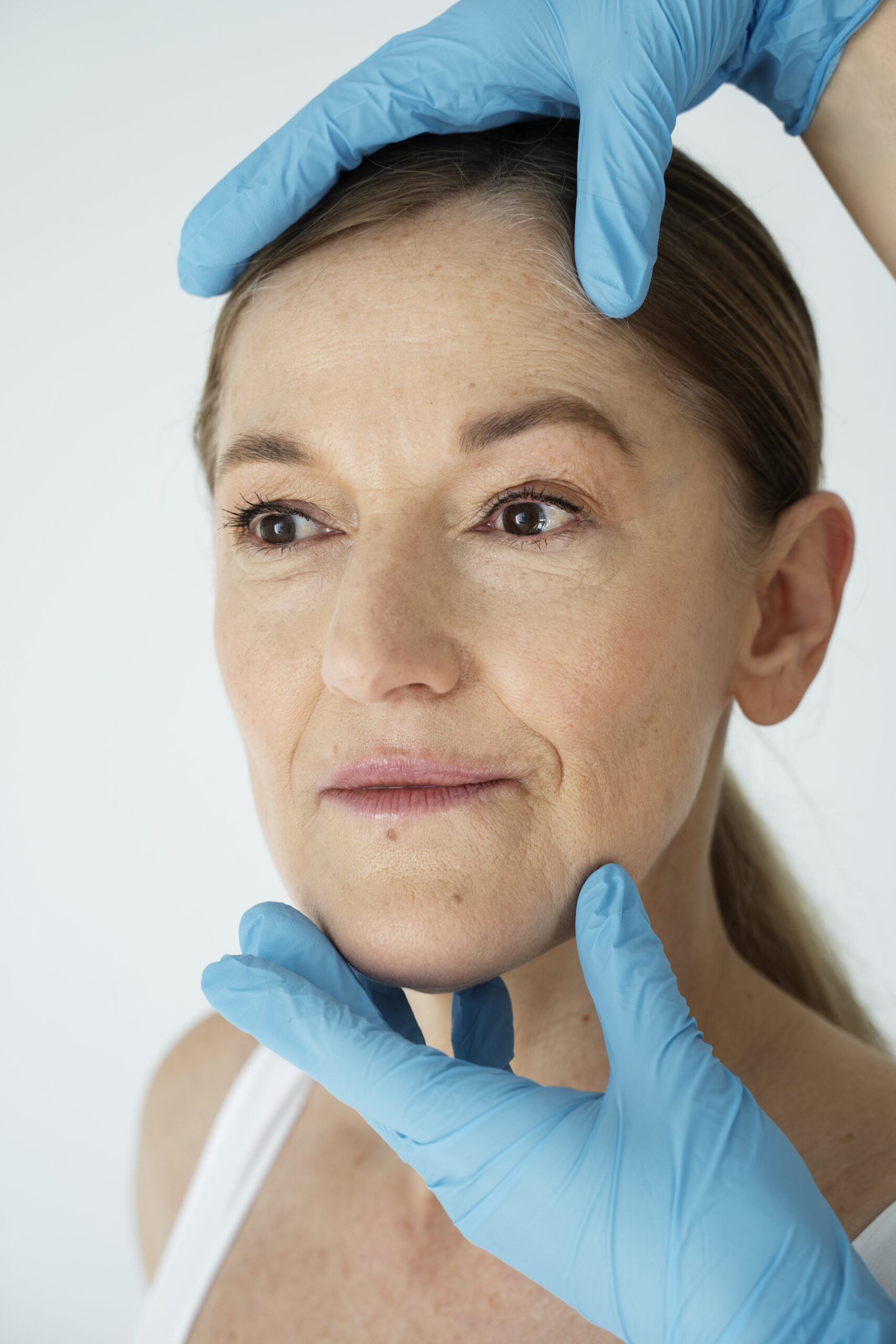 Anti-Wrinkle Treatments in Guildford