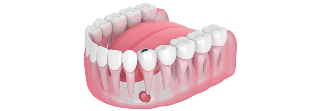 Surrey Dental Blog Image Surrey Dental Blog Image