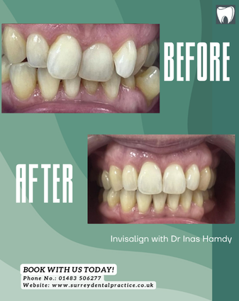 Befor treatment