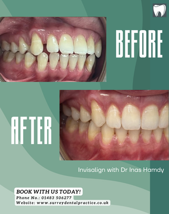 After treatment