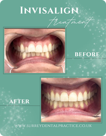 Surrey Dental Center