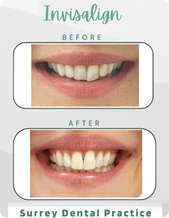 Surrey Dental Center
