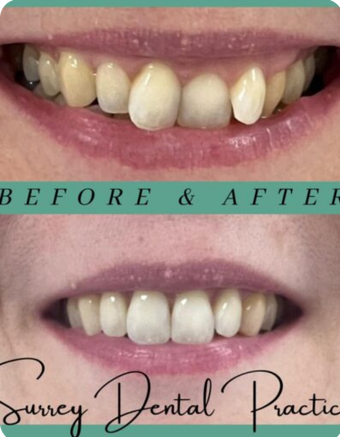 Surrey Dental Center
