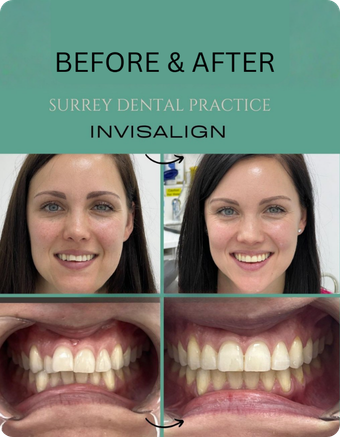 Surrey Dental Center