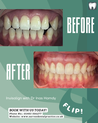 Befor treatment