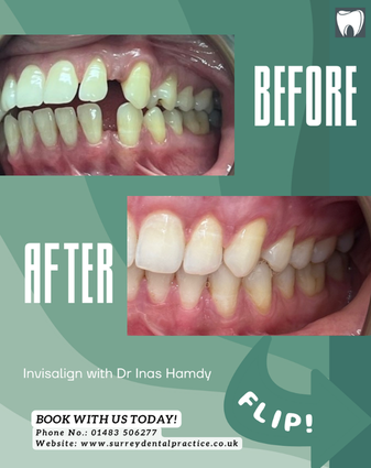 Befor treatment