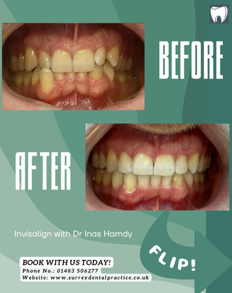 After treatment