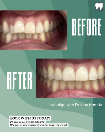 After treatment