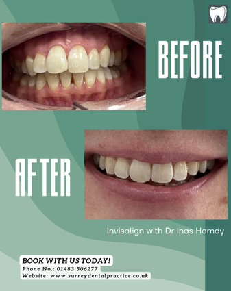 After treatment