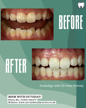 After treatment