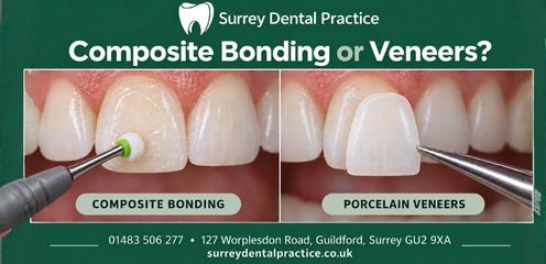 Composite Bonding
