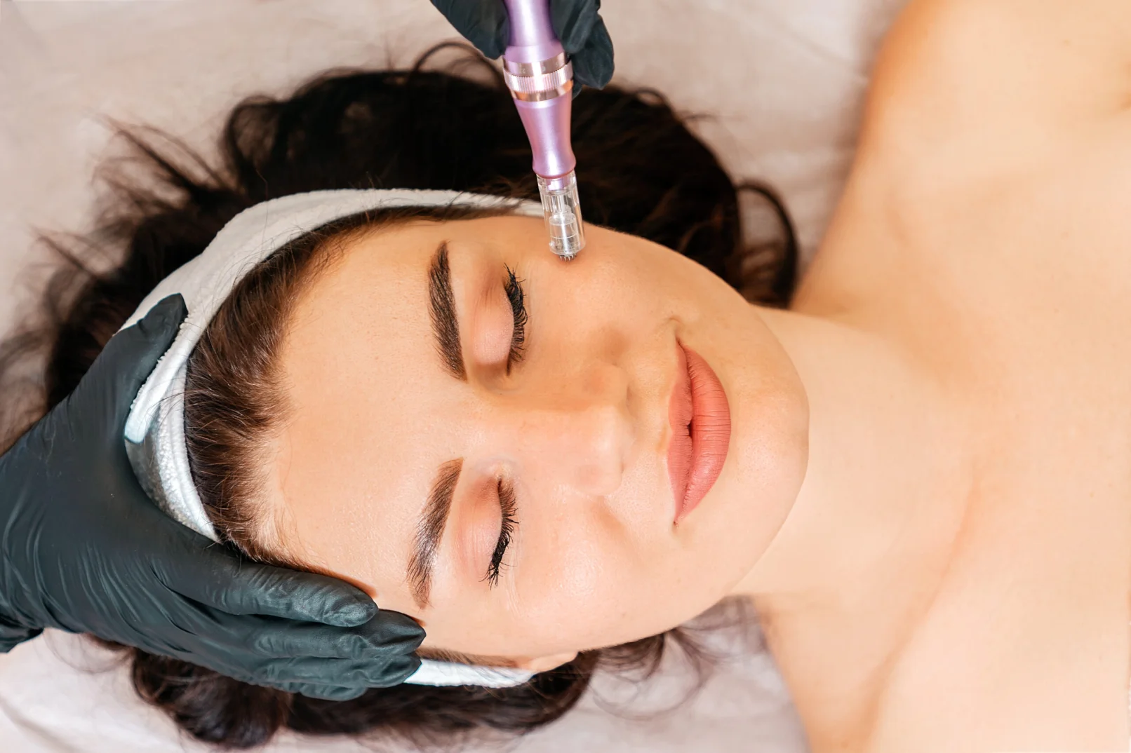 Micro-needling